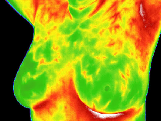 Thermography